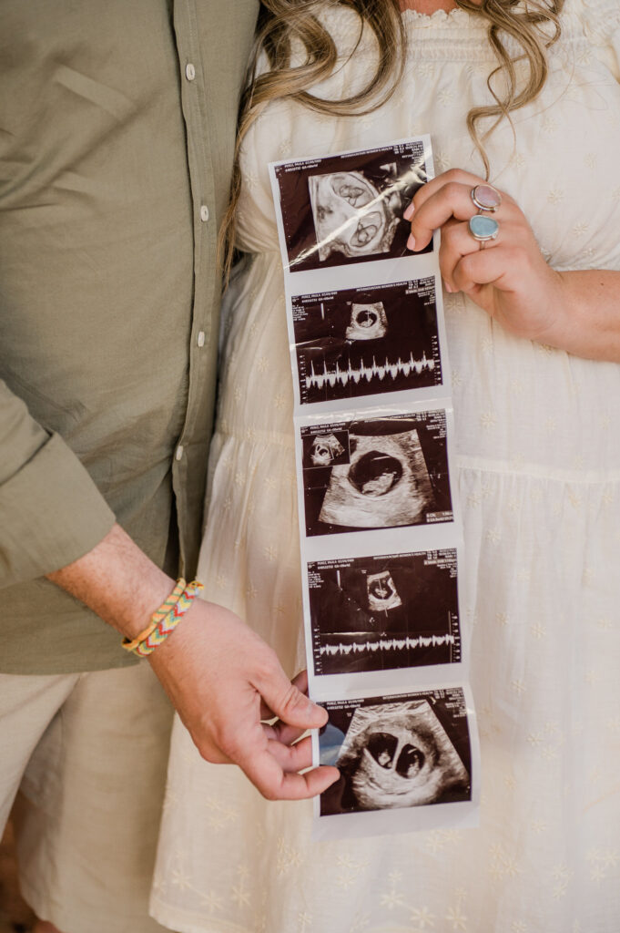 A couple admires their ultrasound images